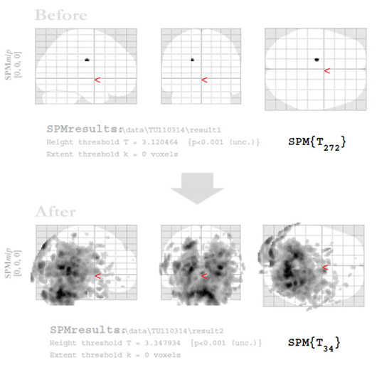 CSFプラクティス（脳脊髄液調整法）